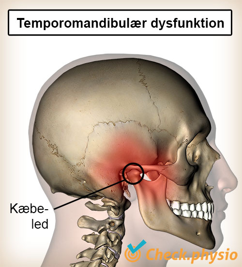 hoved kæbe kæbedisk dysfunktion kæbeled
