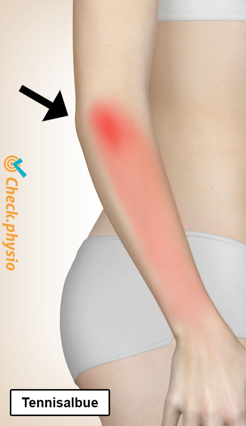 arm tennisalbue placering