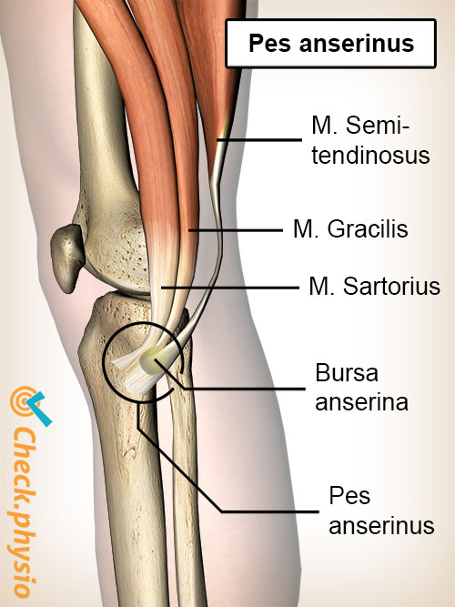 knæ pes anserinus bursa sartorius gracilis semitendinosus sener gåsefod syndrom