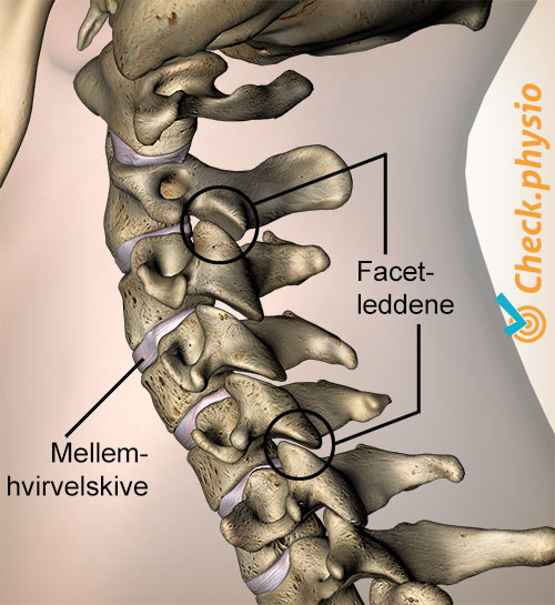 nakke facetled sidevisning lateral diskus