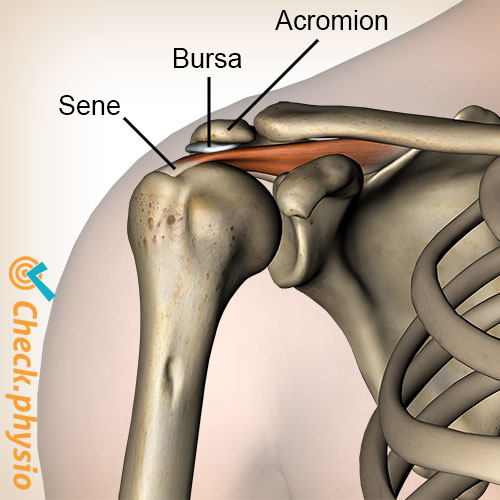 skulder impingement bursa supraspinatus
