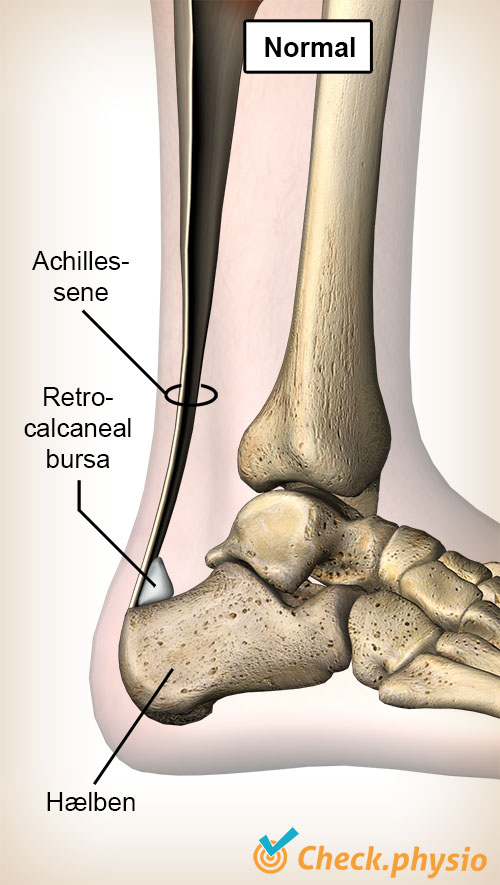 ankel akillessene bursa retrocalcanea hælben calcaneus