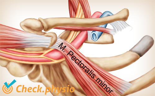 skulder arm hånd TOS thoracic outlet syndrom pectoralis minor
