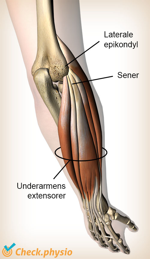 arm ekstensorer